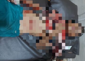 Bocah 12 Tahun di Bontang Diterkam Buaya, Alami Sejumlah Luka