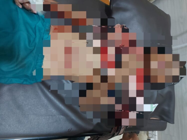 Bocah 12 Tahun di Bontang Diterkam Buaya, Alami Sejumlah Luka